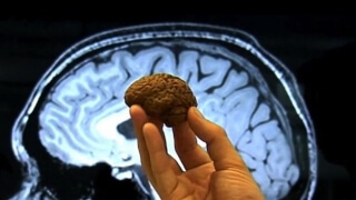 "Мини мозъци" с научна цел заменят тестването върху животни